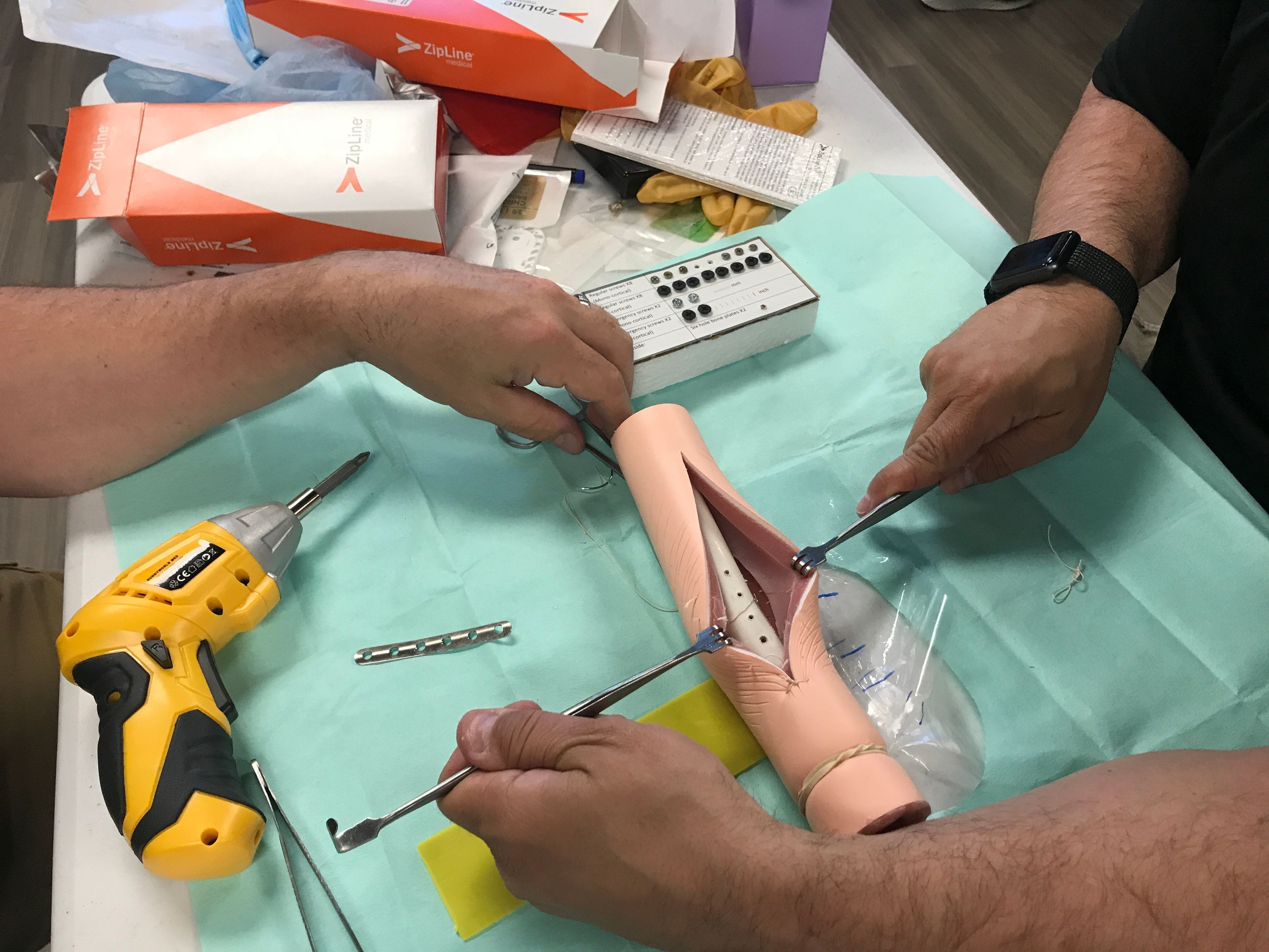 Orthopedic Fracture Casting and Splinting Pictures